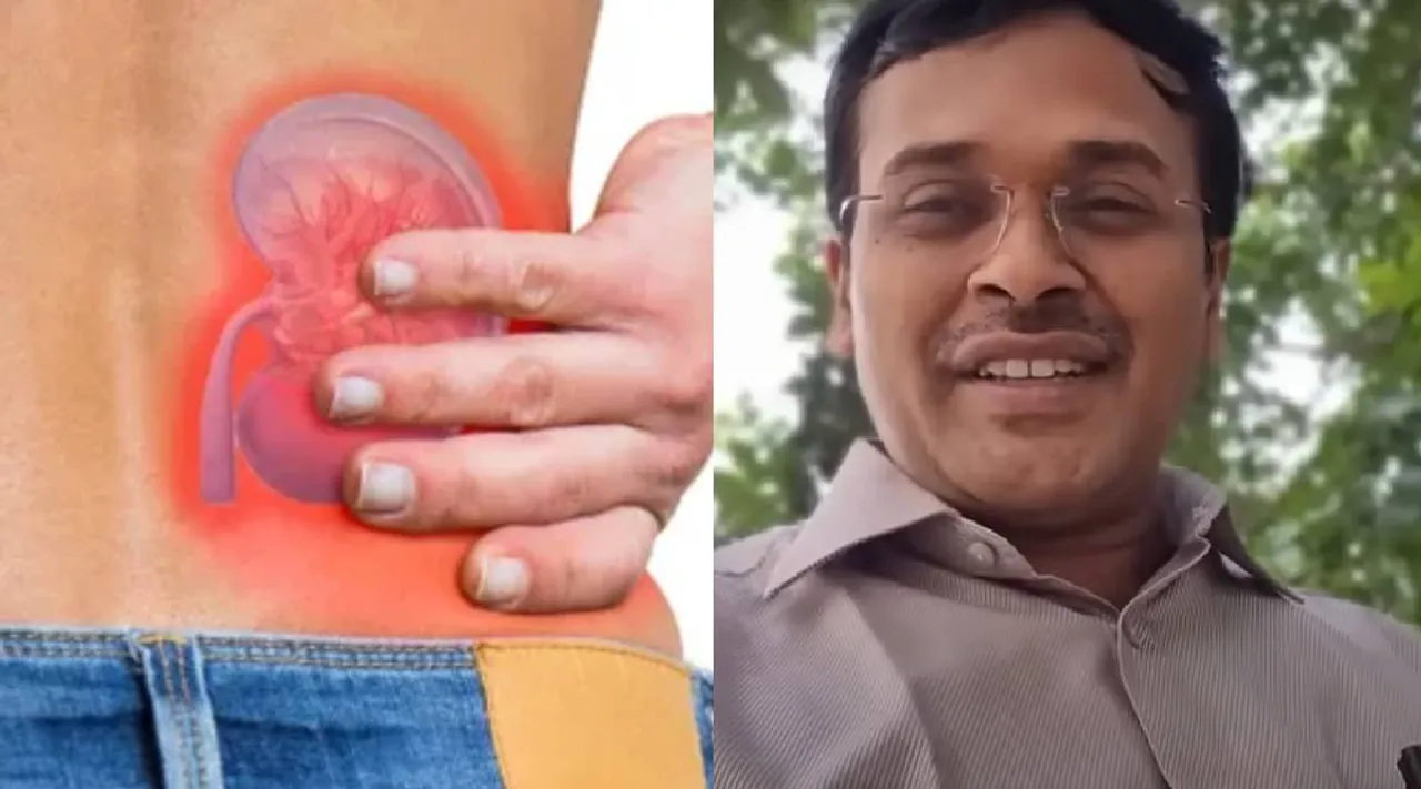 Kidney stone
