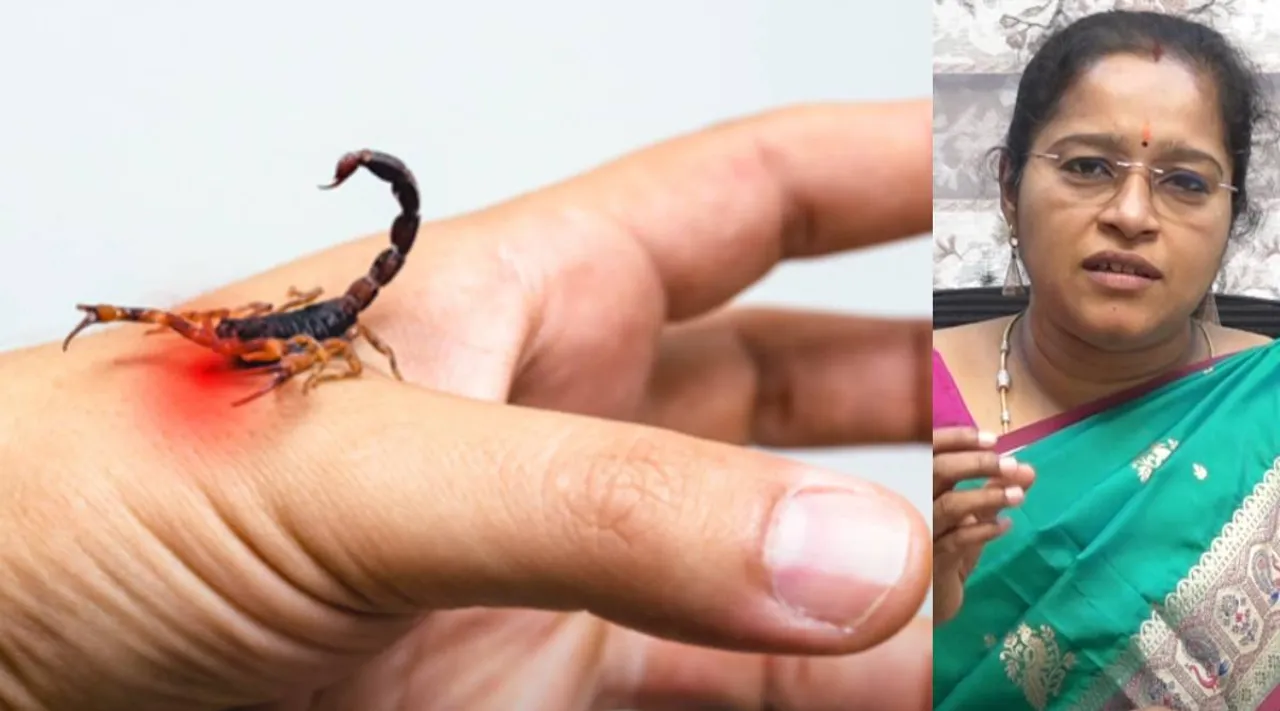 Scorpion sting& Bite