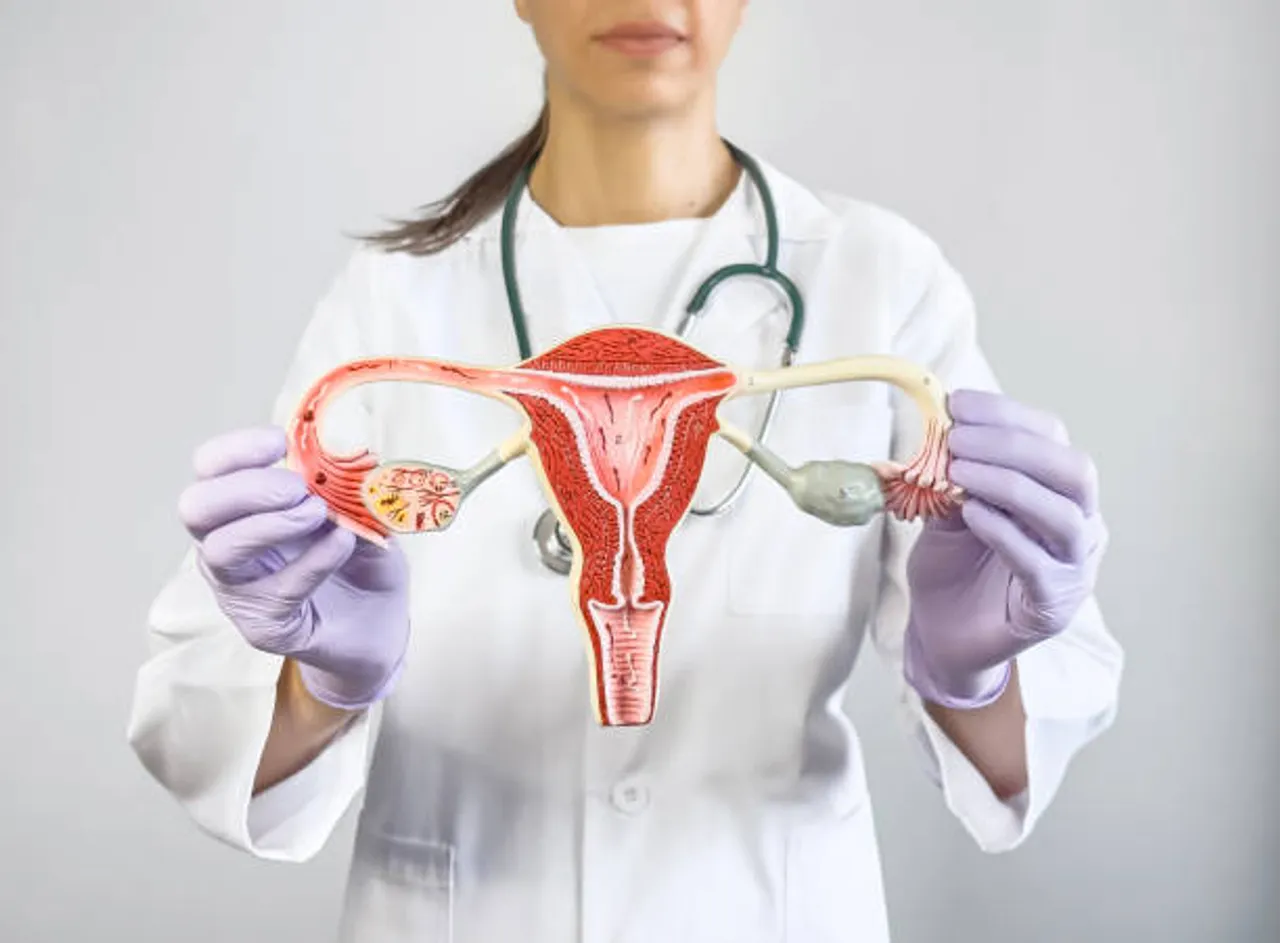 ovarian cancer