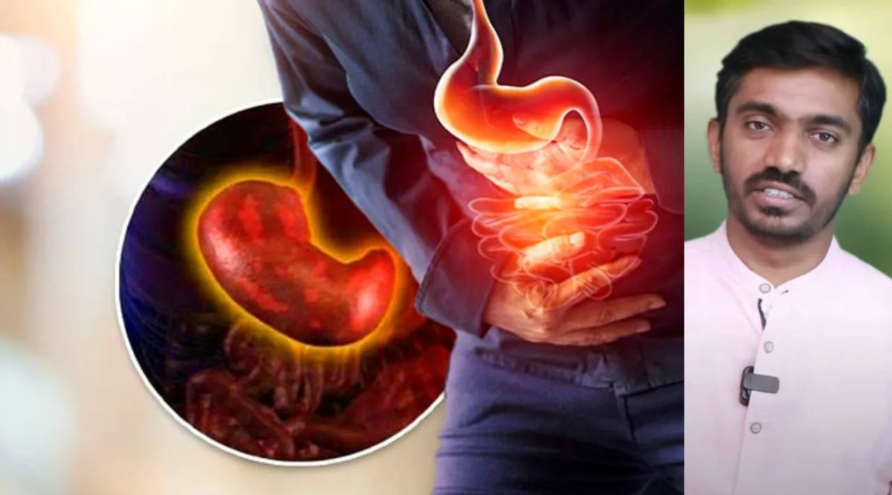 ulcer irritation