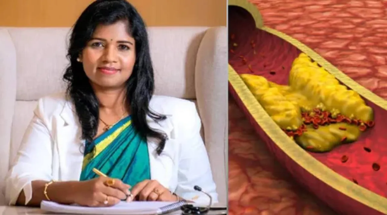 Cholesterol tips