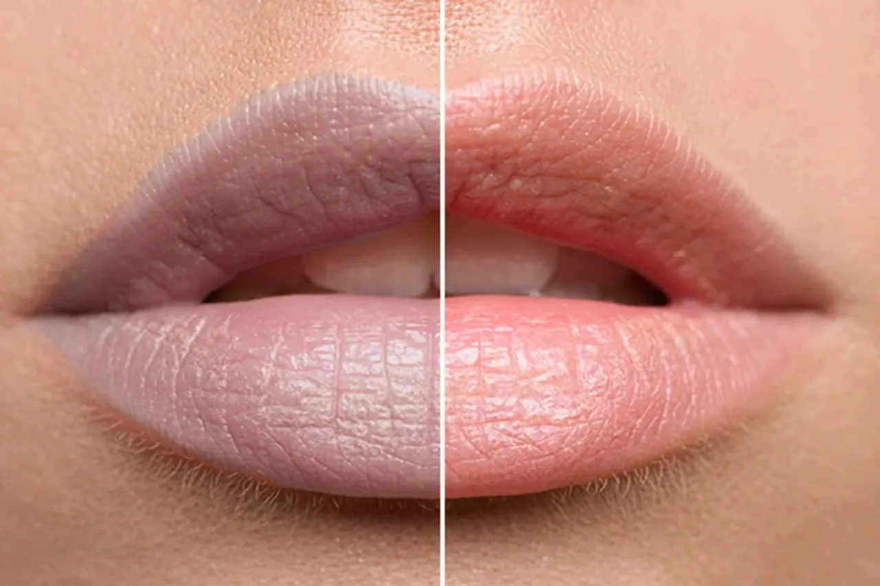 Natural lip care remedies