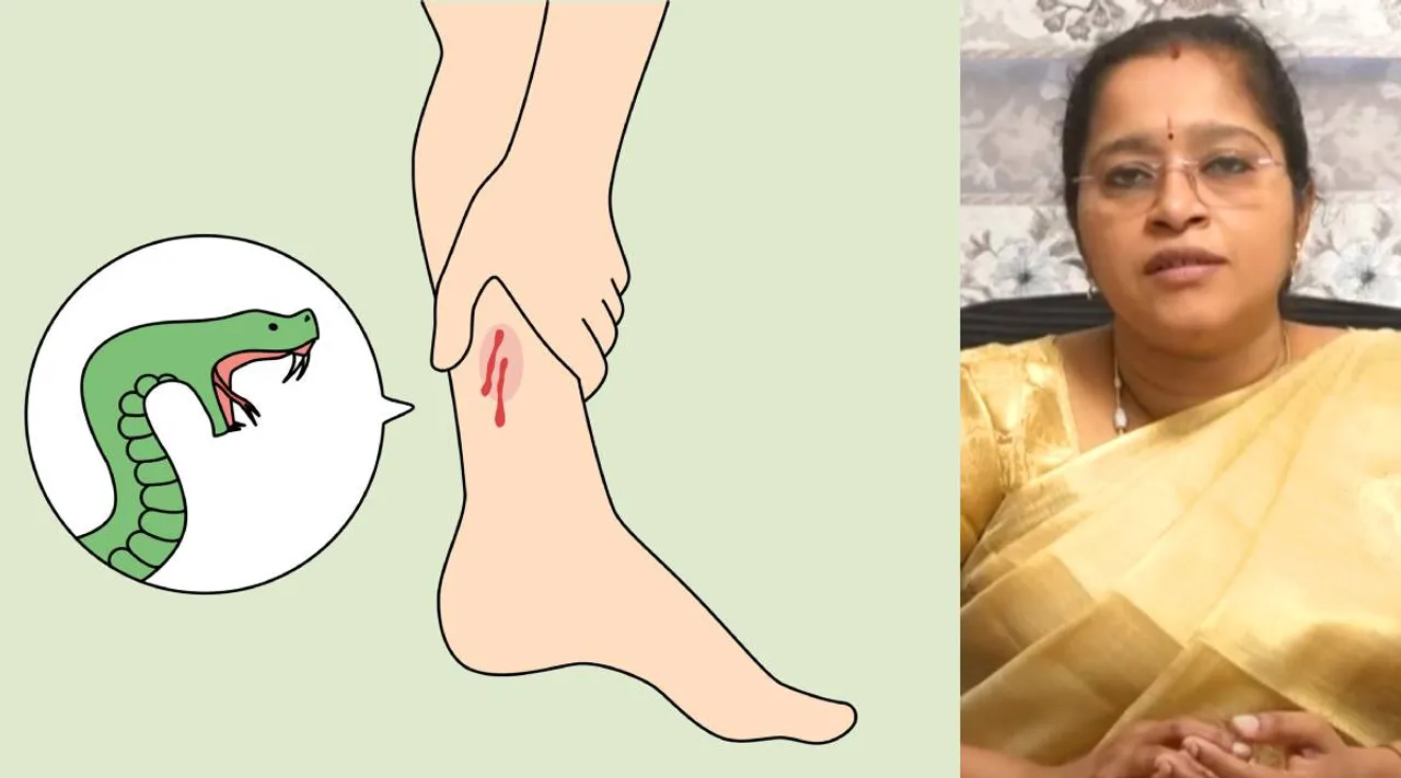 bitten by a snake 
