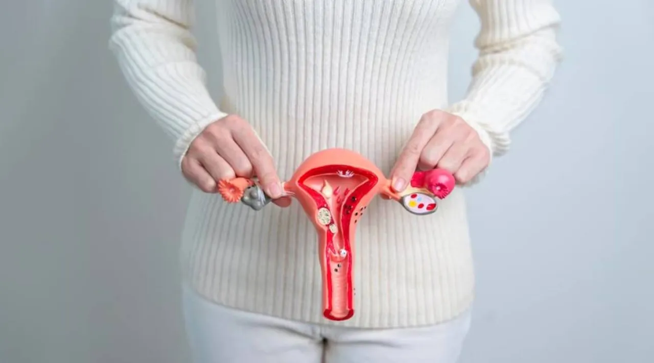 PCOS 