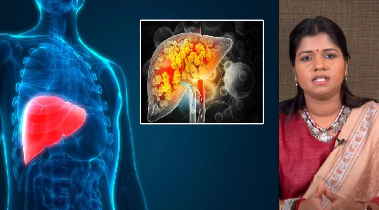 Fatty Liver causes