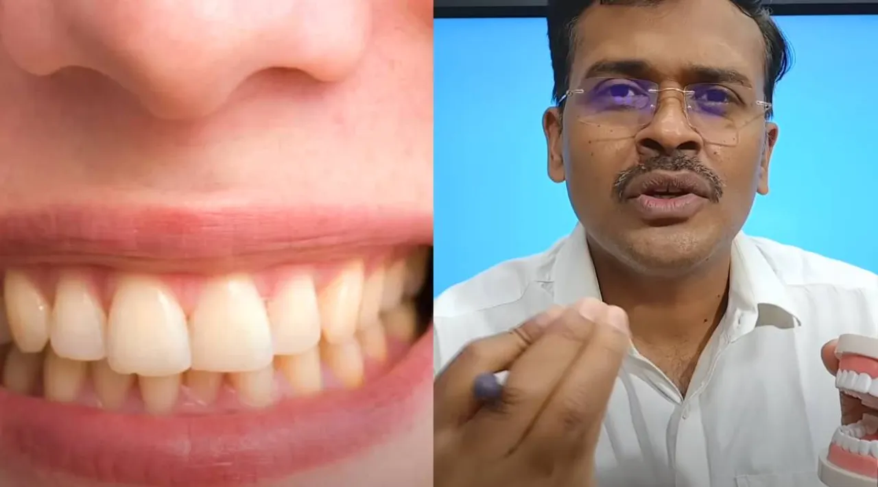 Gums and Grow Back?