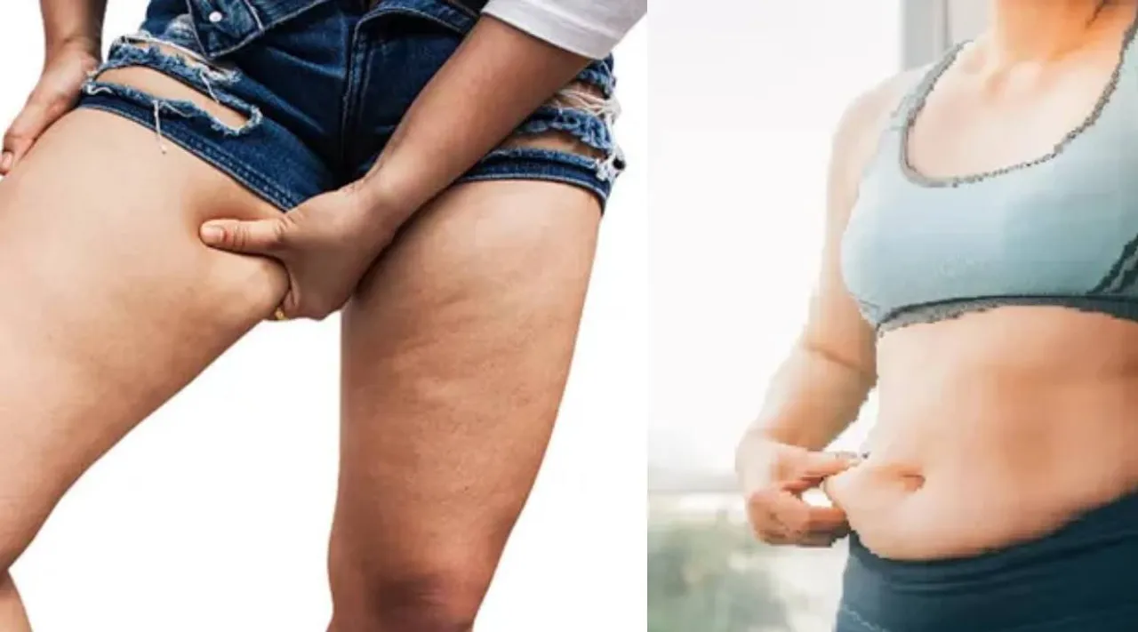 Hip and thighs fat