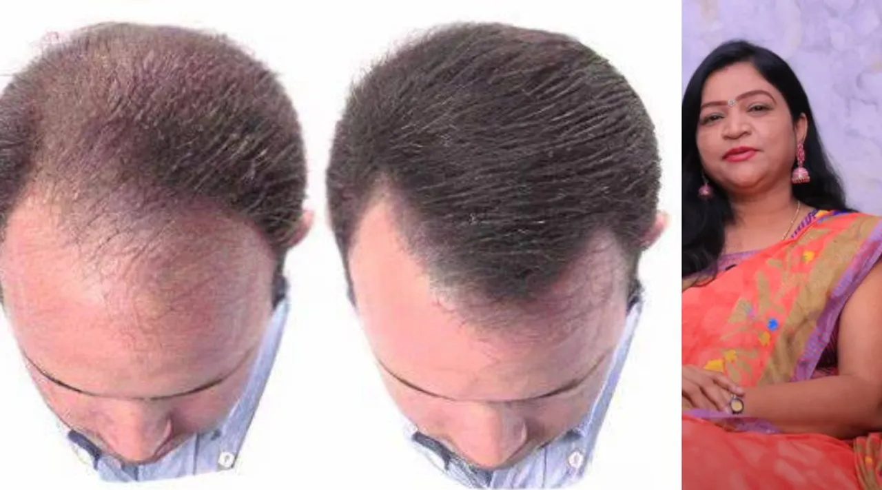hair will grow like 