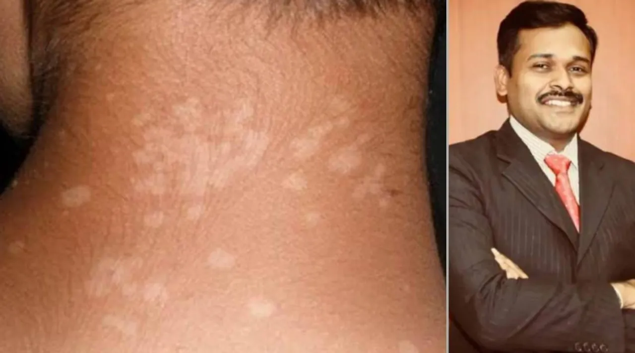 white spots on your s