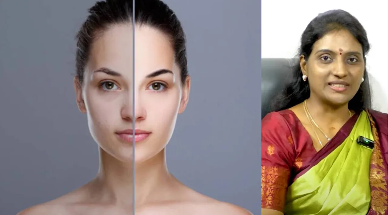 dark spots on your face; D