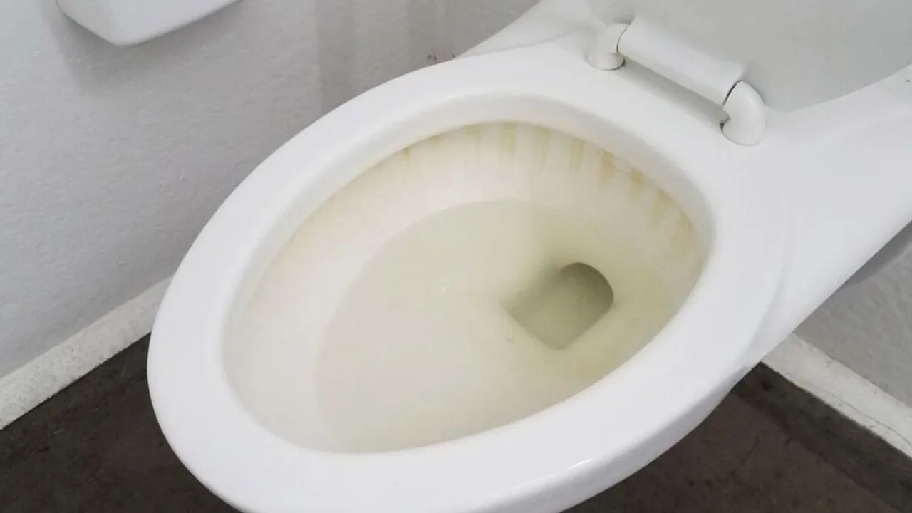 Toilet yellow stain remover
