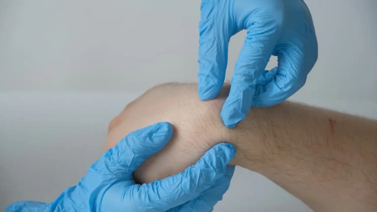 lipoma