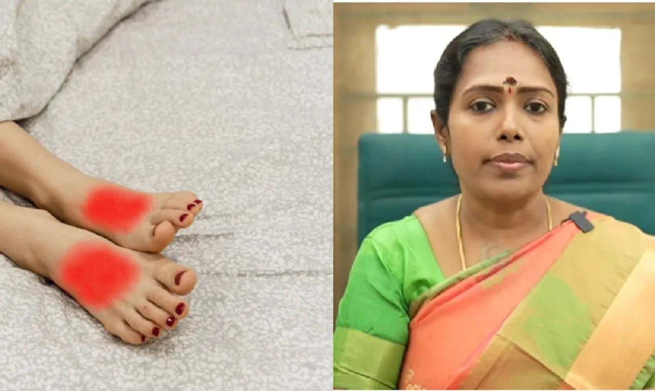 Burning feet home remedies