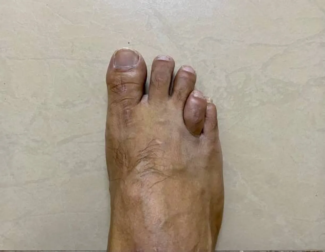 foot