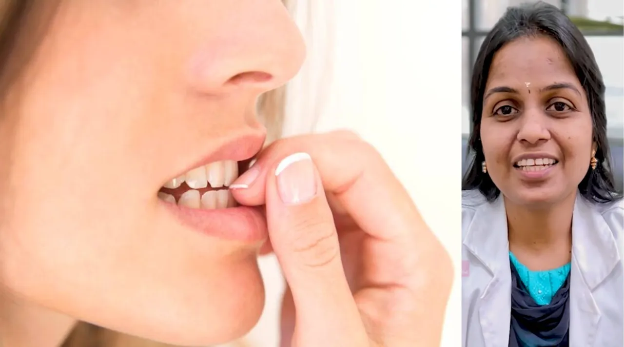 f bacterial infection
