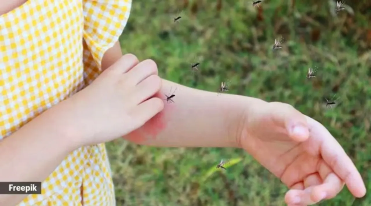 mosquito bites