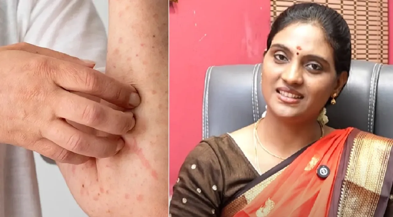 Siddha skin care Dr Nithya