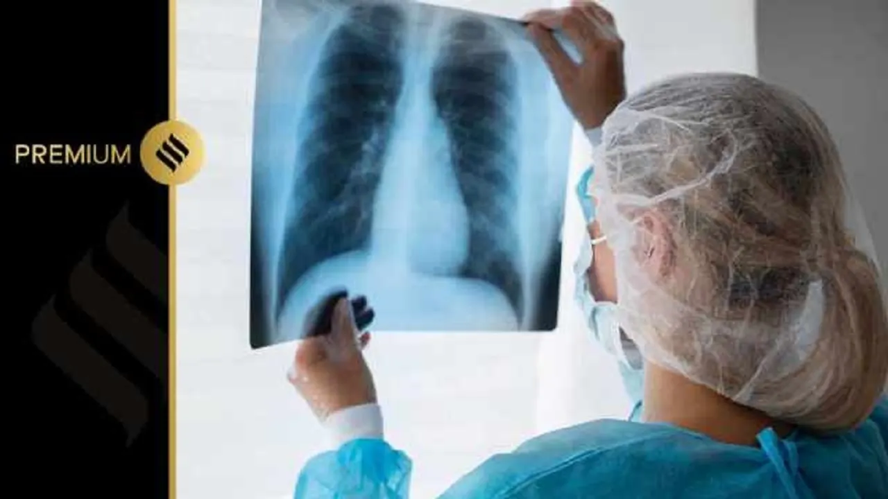 Tamil Nadu Tuberculosis Death Reduction