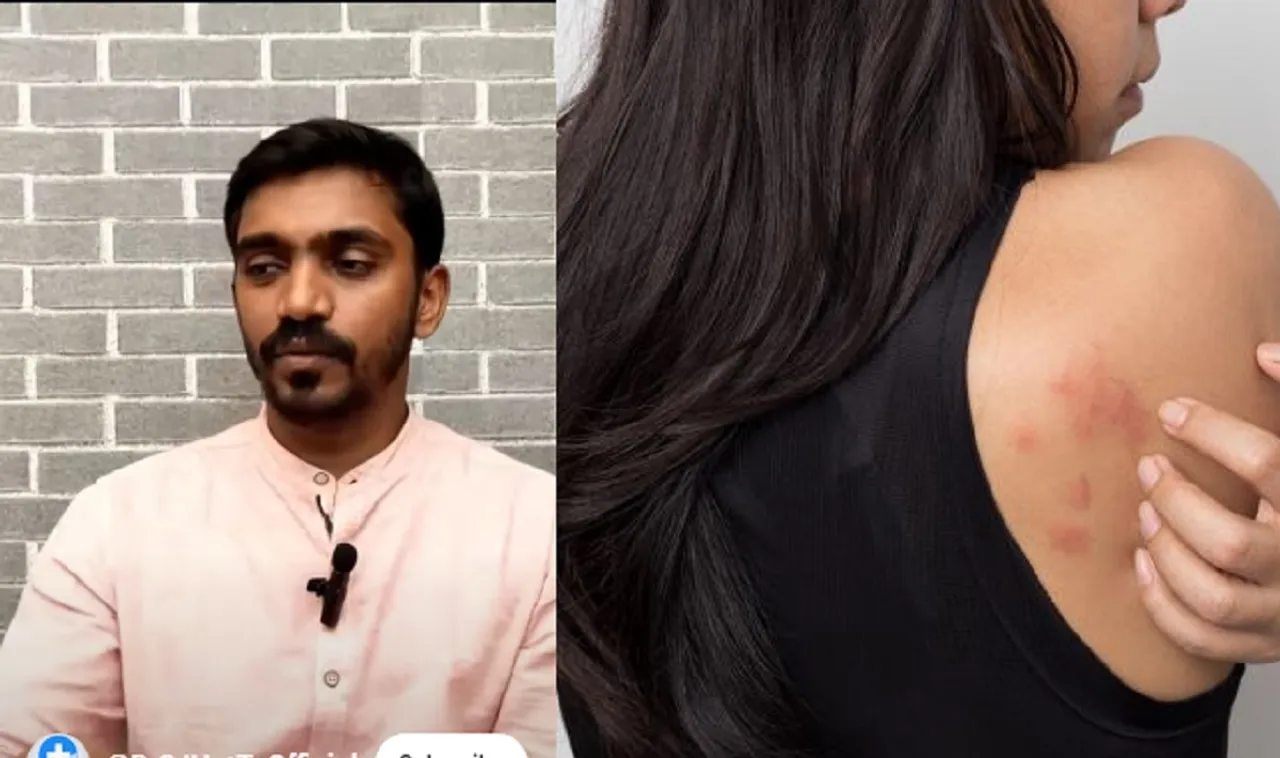 Skin Rashes Home Remedies Dr Sengottaiyan