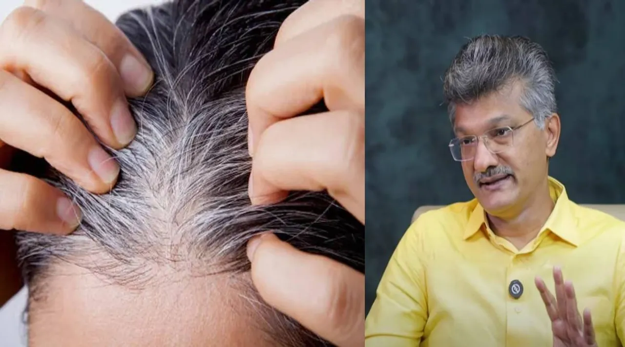 white hair
