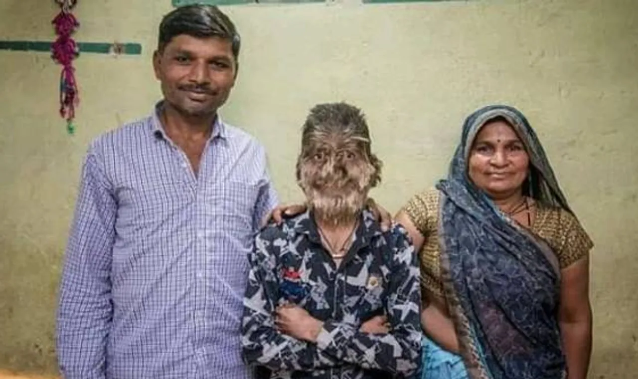 lalit patidar