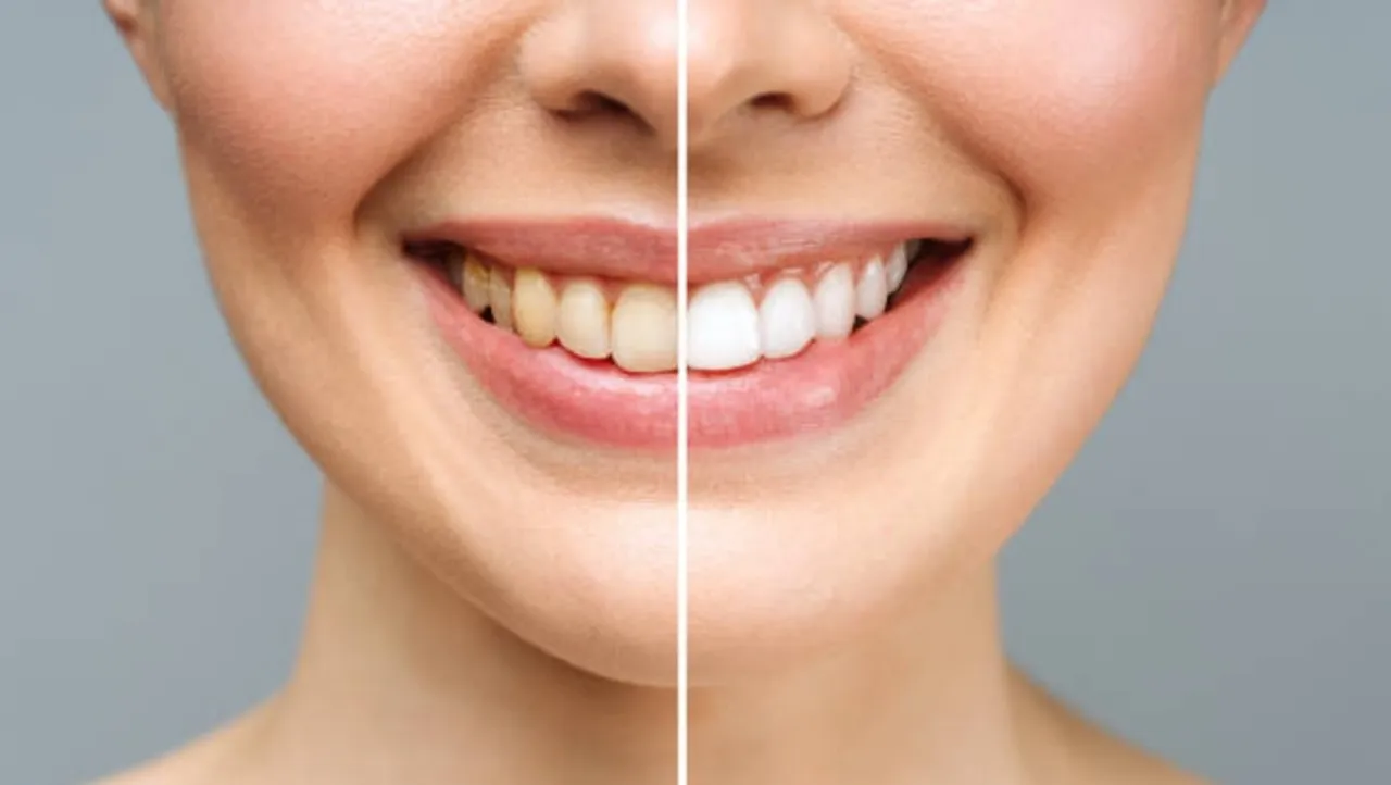 istockphoto-1361598488-612x612 (1)