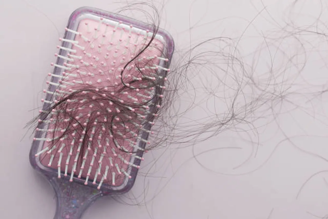 alopecia