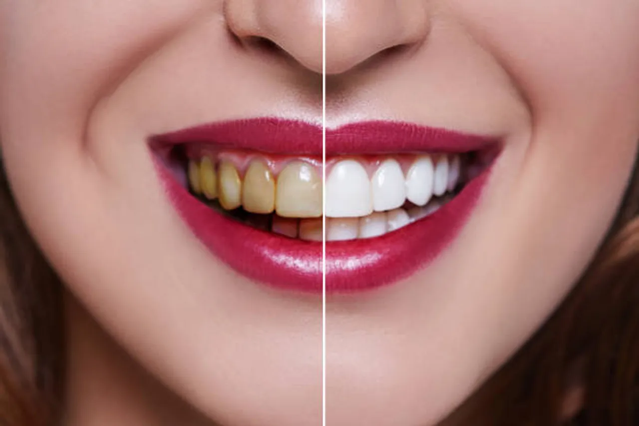 teeth