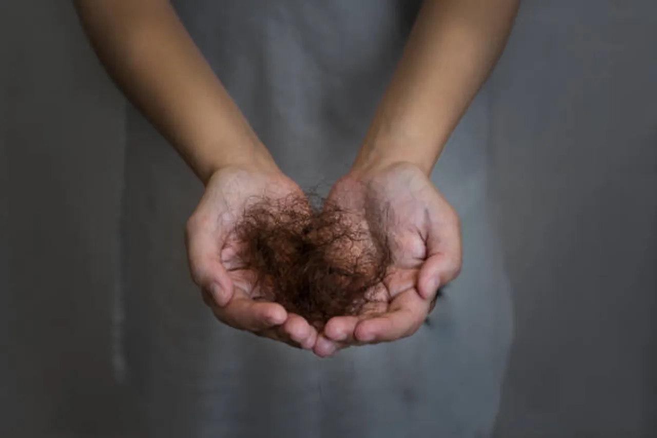 hairfall