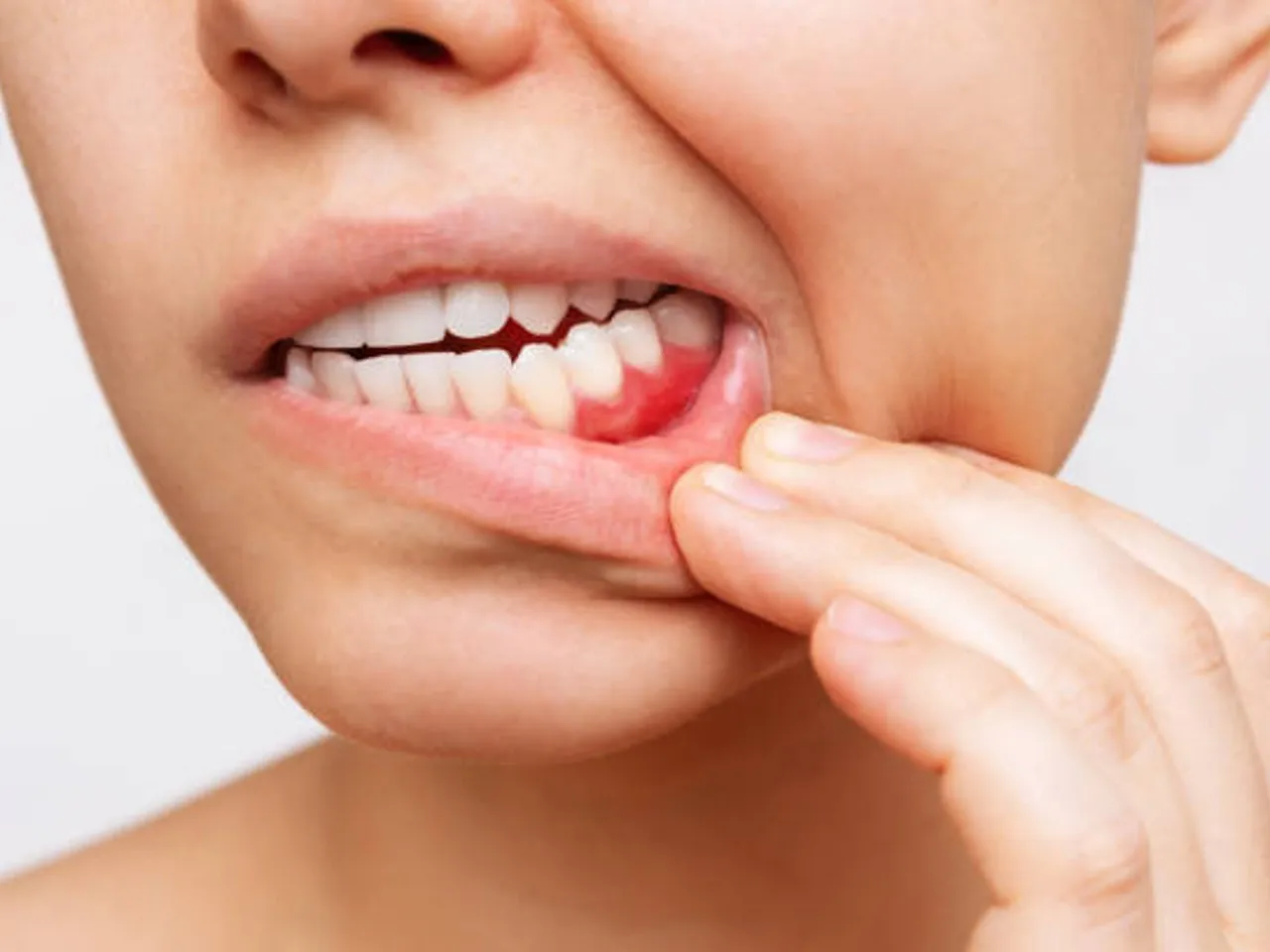 tooth