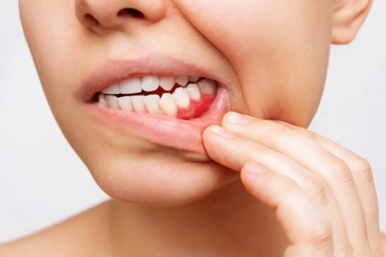 teeth