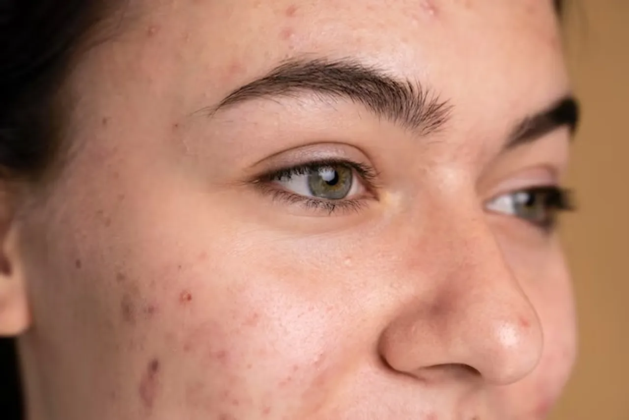 Pomegranate Peel Skin Care