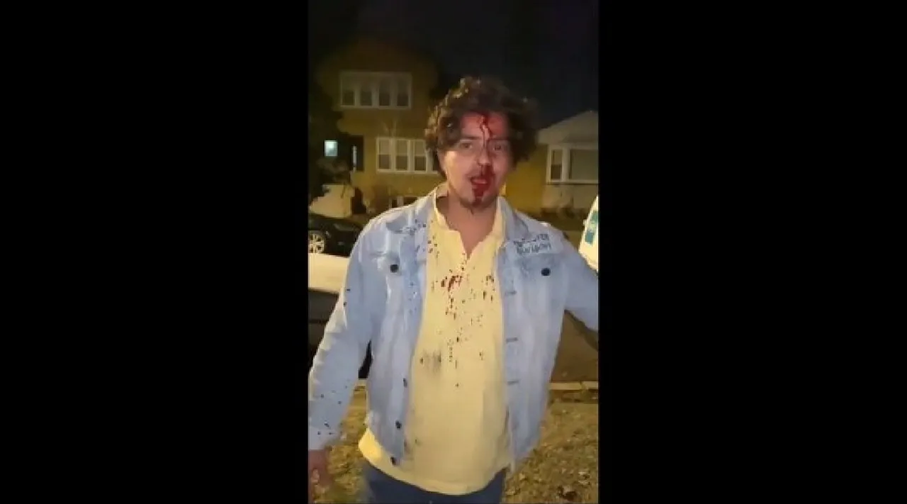 Indian student attacked in Chicago issues video plea Tamil News 