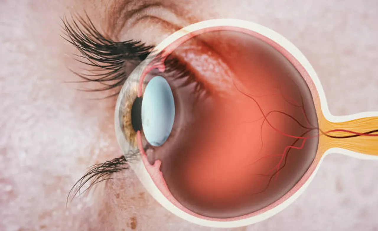 eye