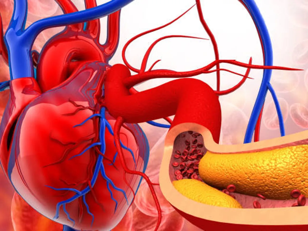 arteries