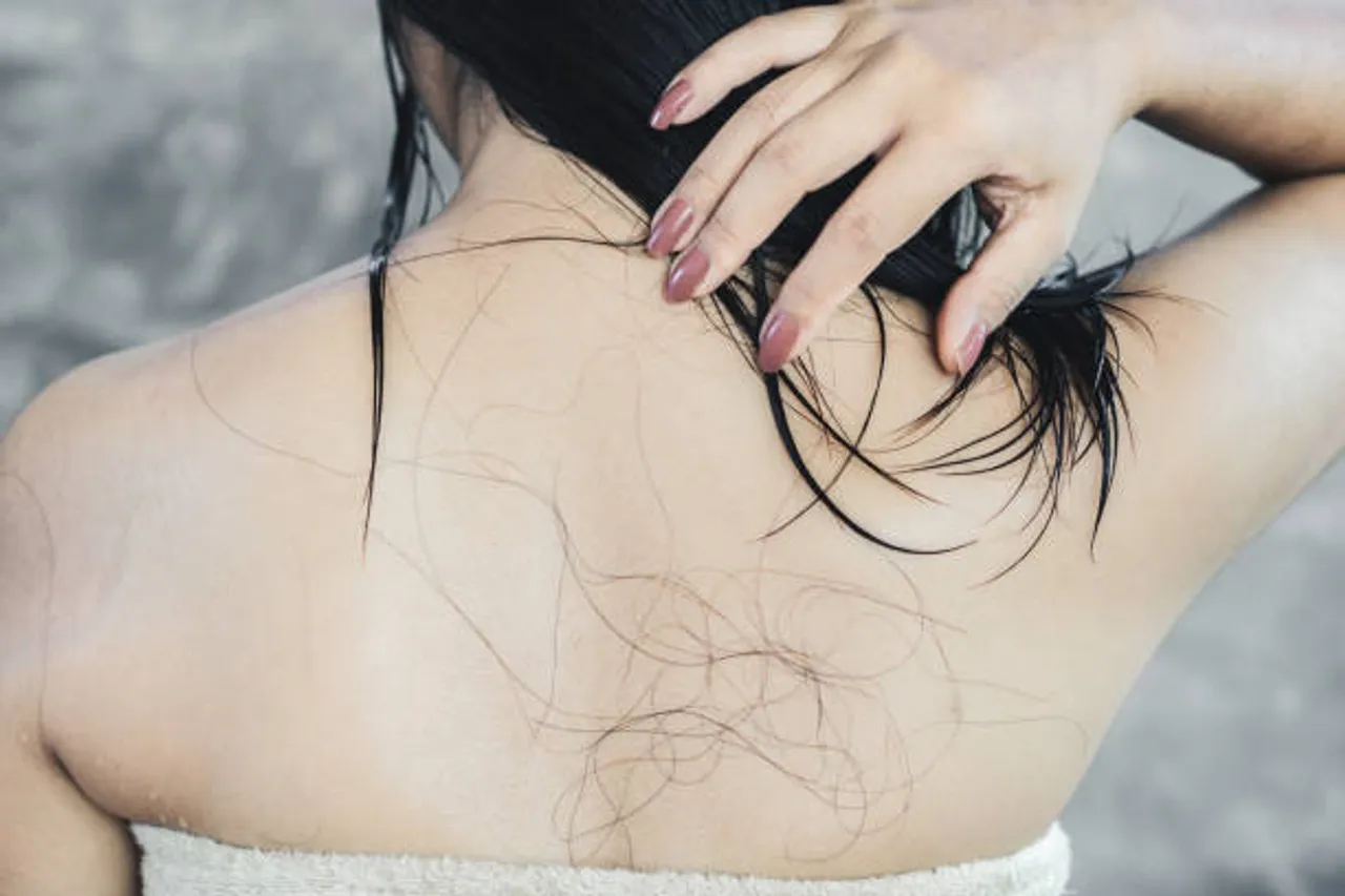 hairfall