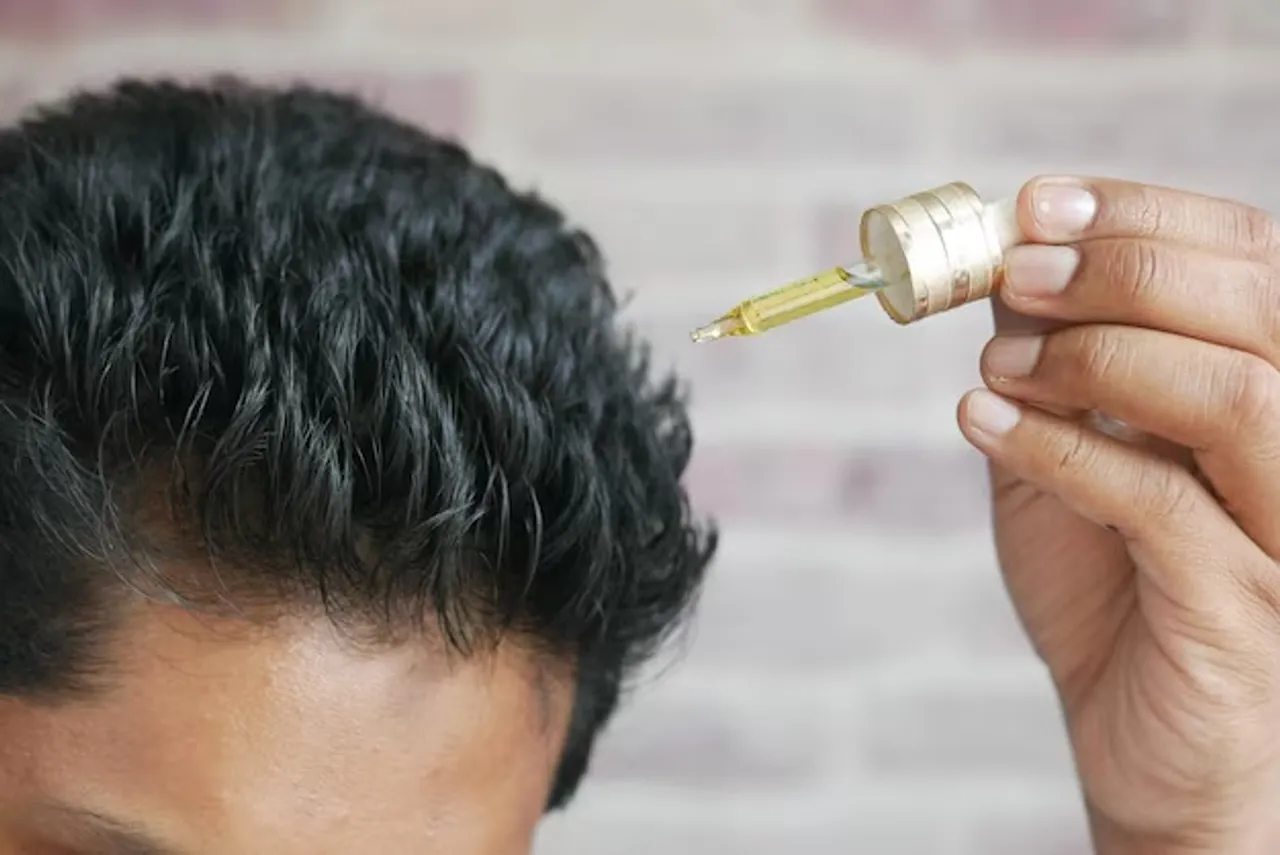 hairfall 