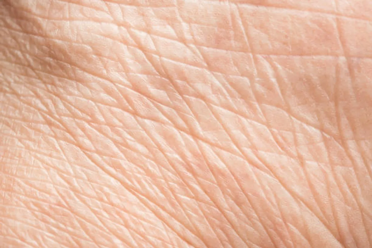 wrinkles