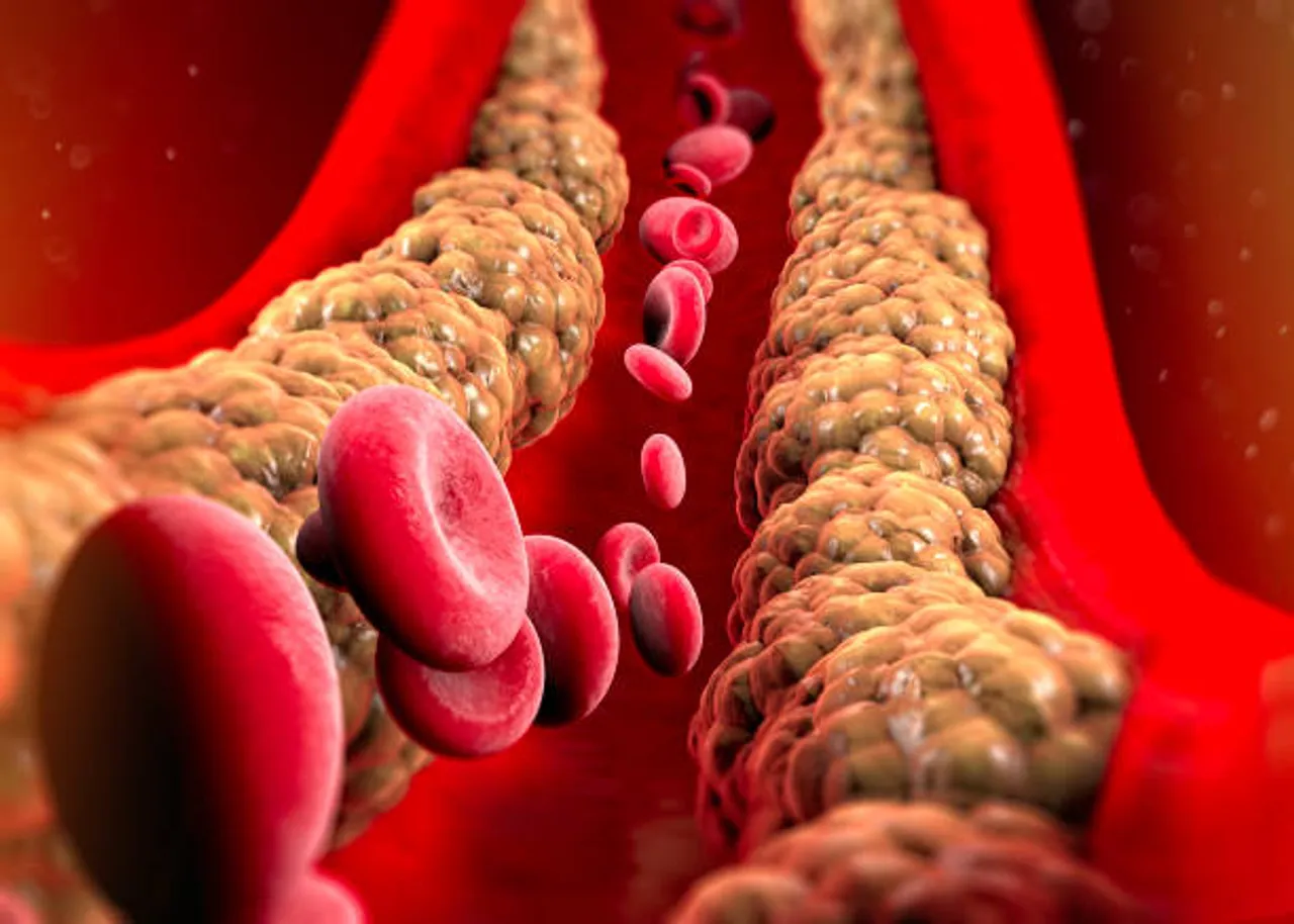 cholesterol