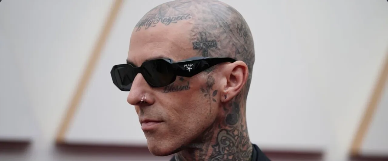 Travis Barker to Get Surgery Before Going on The Blink-182 Tour!