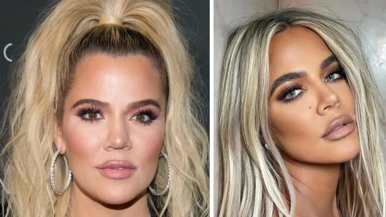 Khloe Kardashian Sparks Plastic Surgery Speculation