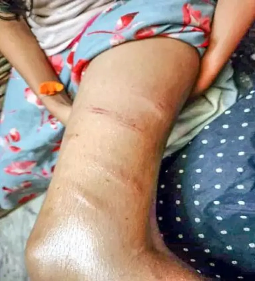 GIRL BEATEN