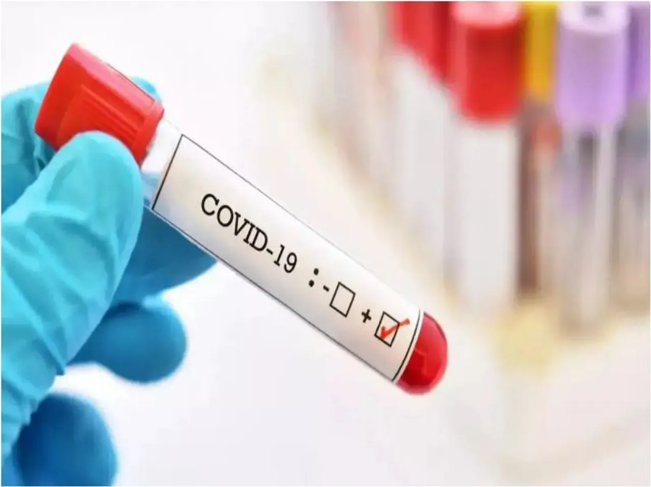COVID CASES
