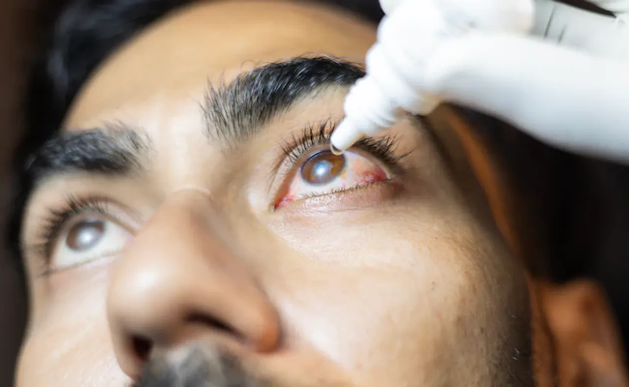 eye drops