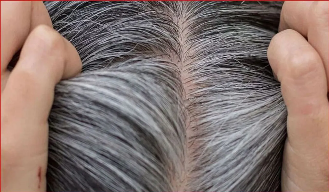 അകാലനര നിങ്ങളെ അലട്ടുന്നുണ്ടോ? പ്രതിവിധി ഇതാ