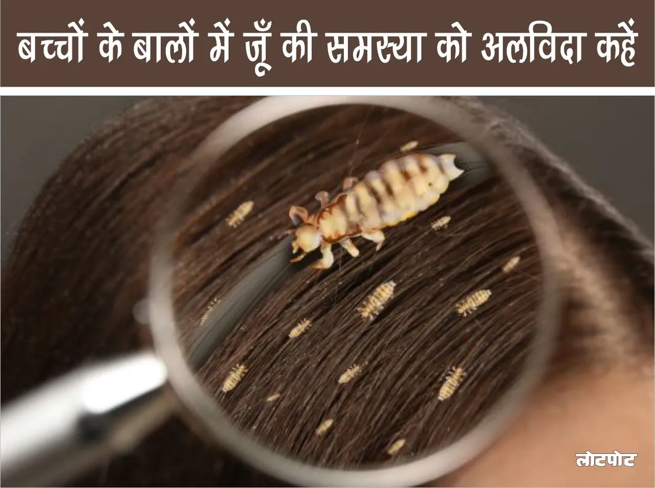 Say goodbye to the problem of lice in children hair