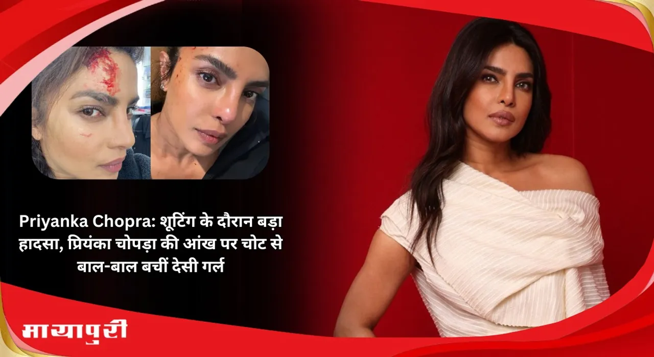Priyanka Chopra: Big accident during the shooting of Priyanka Chopra film severe injury in the eye