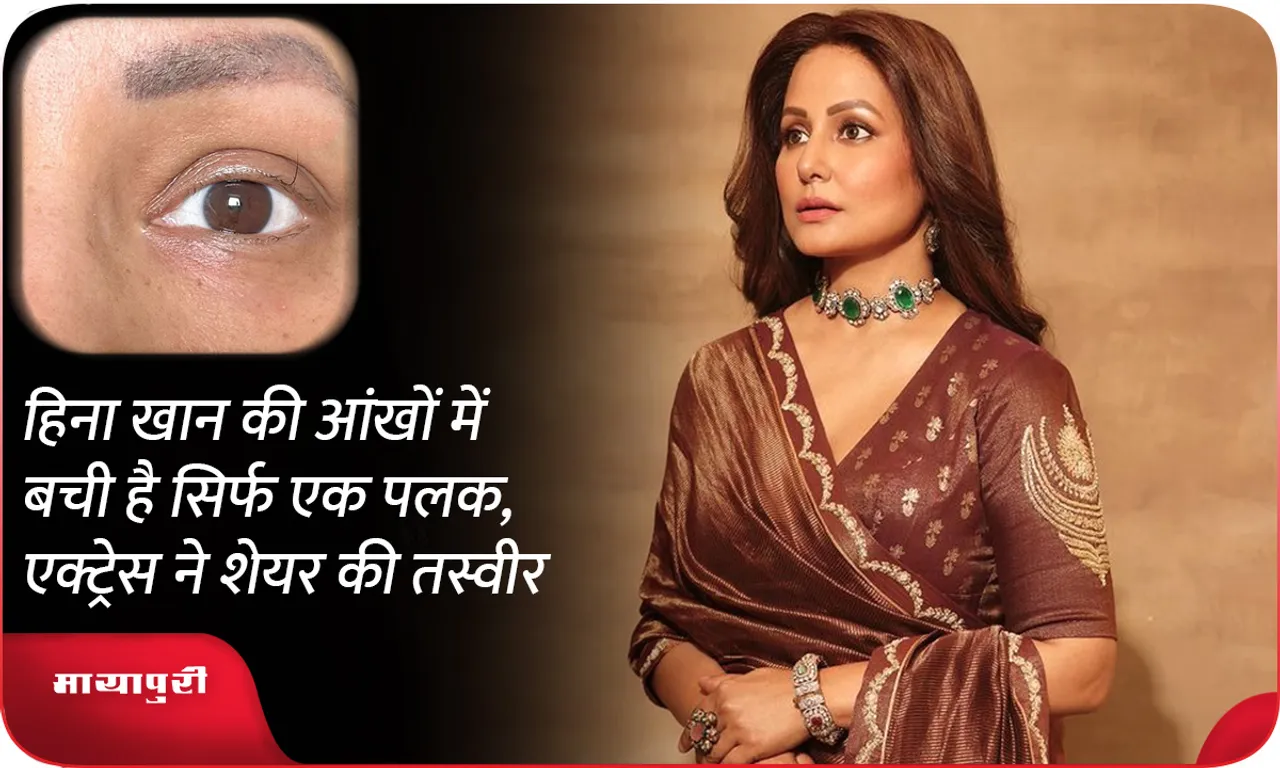 Hina Khan shares pic of her last standing eyelash amid cancer treatment