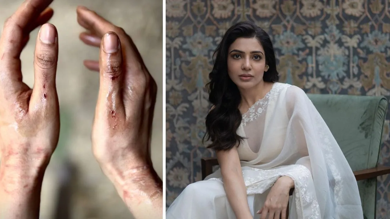 Samantha Ruth Prabhu injured on sets of Citadel