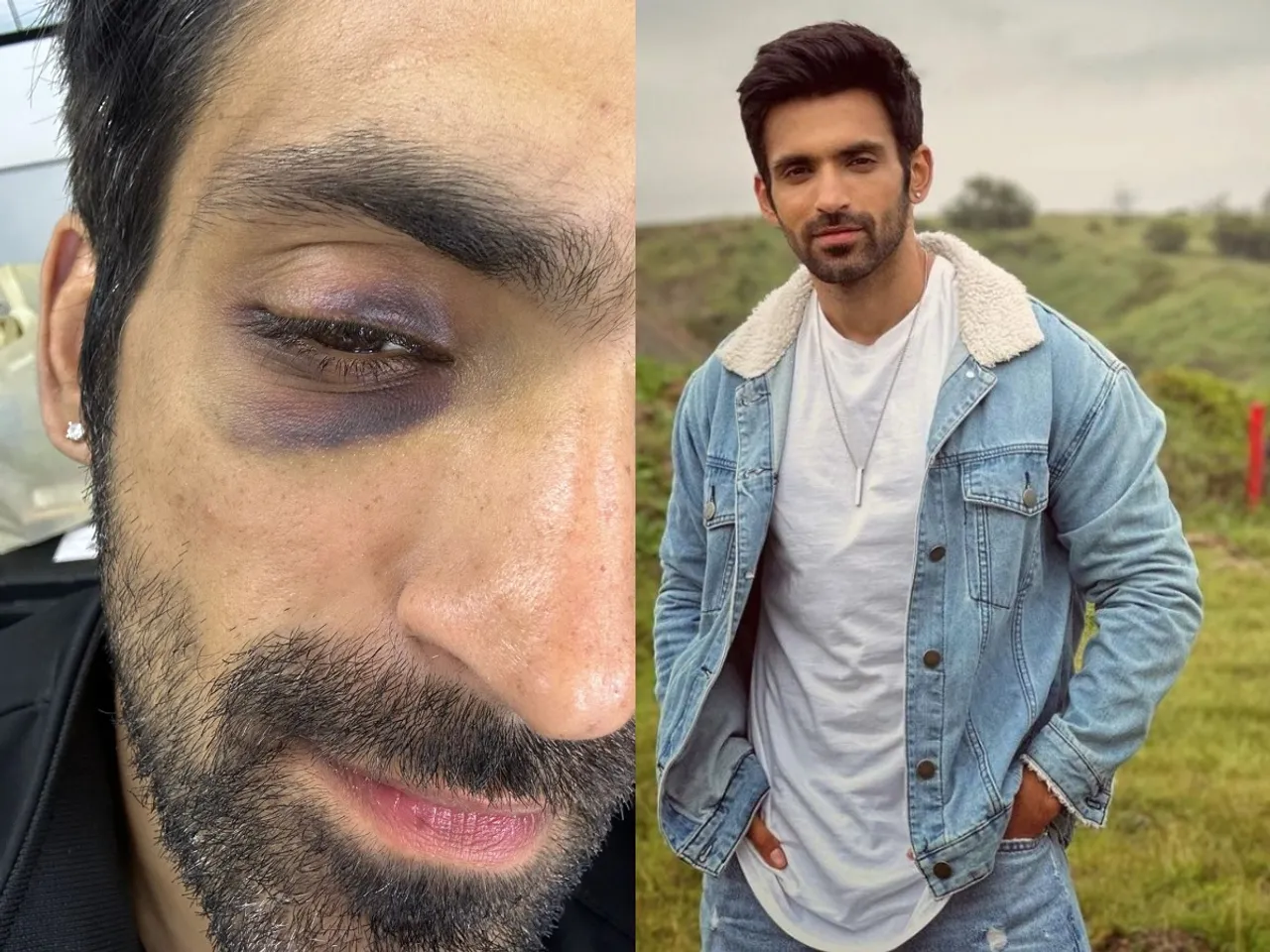 Khatron Ke Khiladi Season 13: अरिजीत तनेजा हुए घायल!